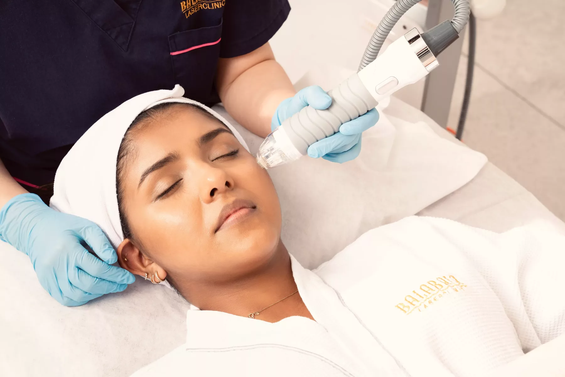 Vivace RF Micro-needling
